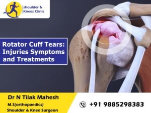 Read more about the article Rotator Cuff Tears: Injuries Symptoms and Treatments
