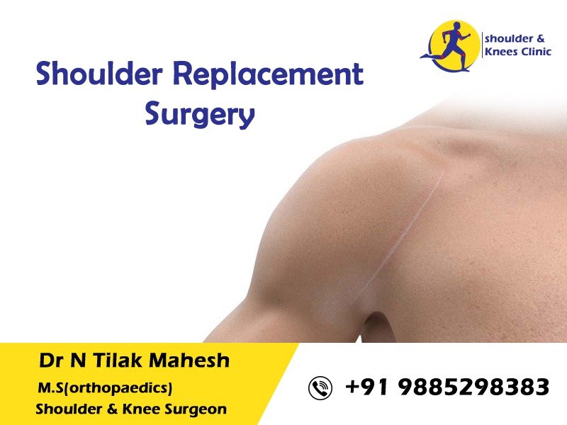 Read more about the article Shoulder Replacement Surgery