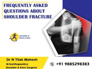 Read more about the article Frequently asked questions about shoulder fracture. 