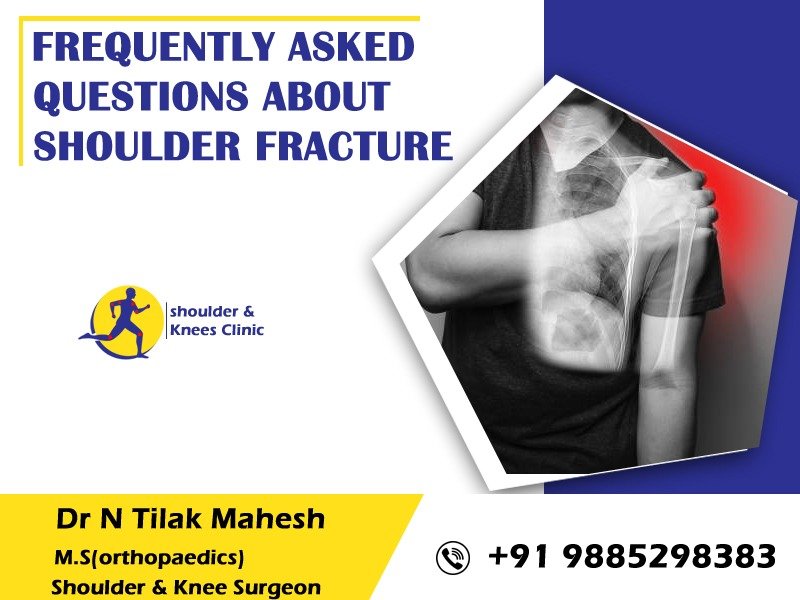 You are currently viewing Frequently asked questions about shoulder fracture. 